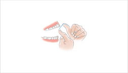 挿入の仕方 上の歯への挿入の仕方1