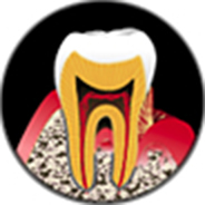 歯周病確立期