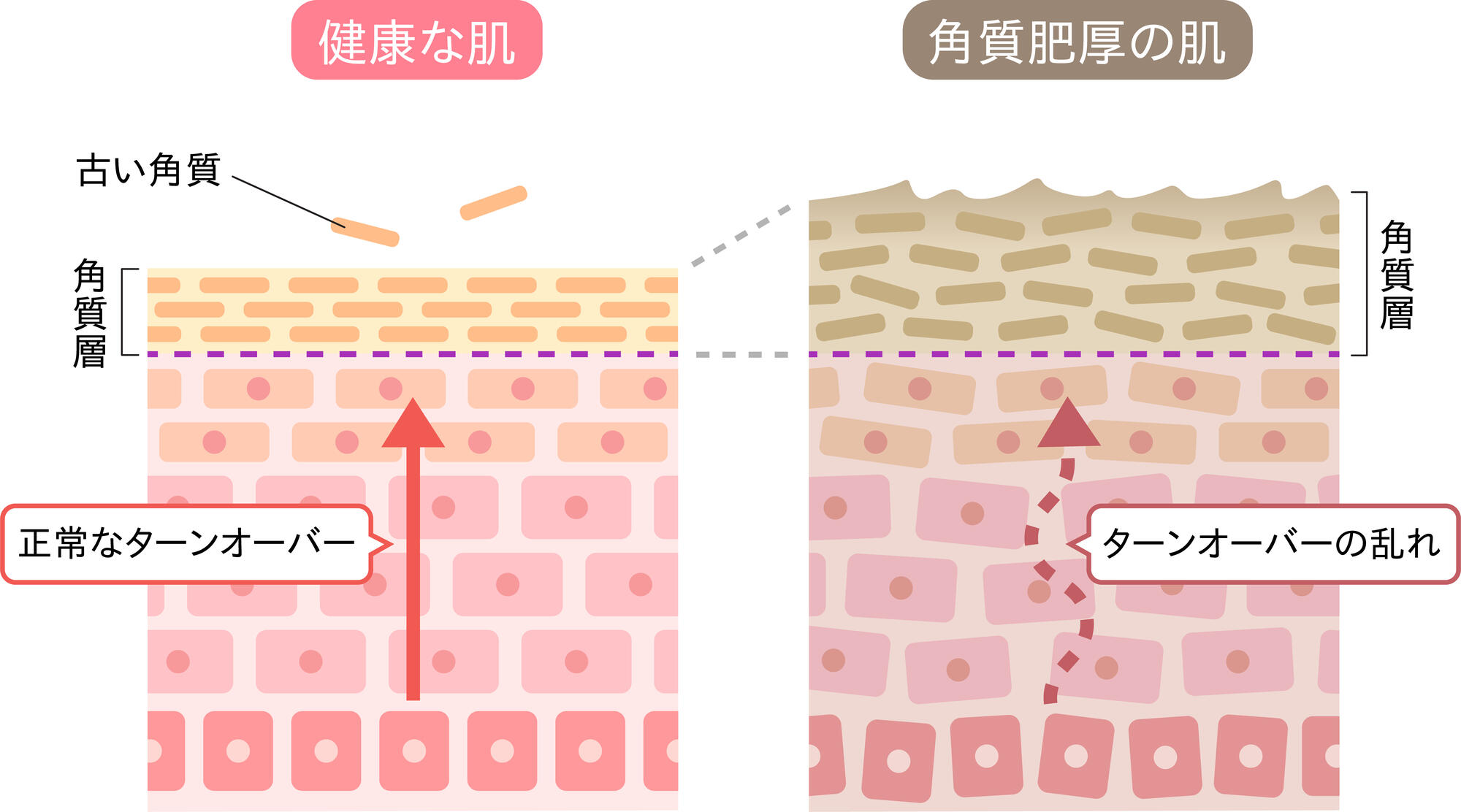 20260803_Stratum Corneum Care.jpg