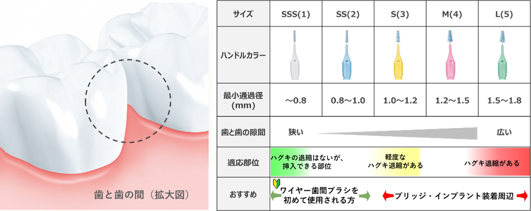 I字歯間サイズ表