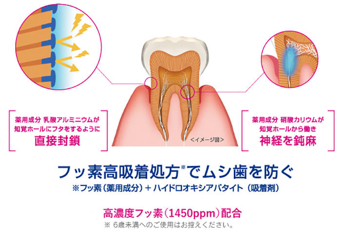 知覚ホールを直接封鎖
