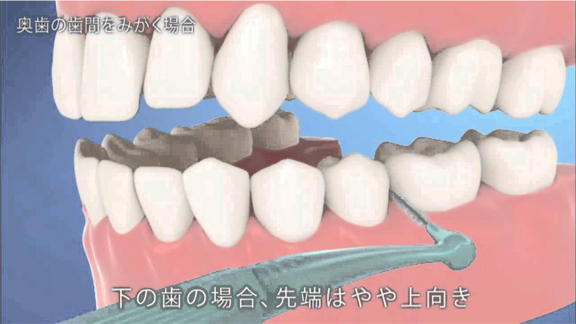 最大57%OFFクーポン ガム 歯間ブラシ L字型 奥歯の歯間ケア ワイヤータイプ SSS