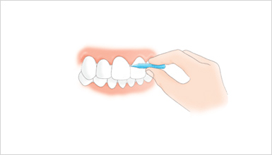 歯間ブラシの種類 I字型