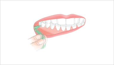 奥歯 歯間ブラシの使い方2